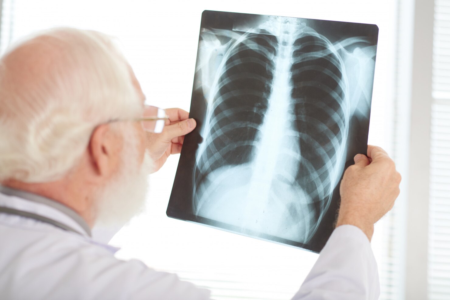 Pleural Effusion, Empyema & Pneumothorax (छाती में पानी, मवाद एवं न्यूमोथोरेक्स)
